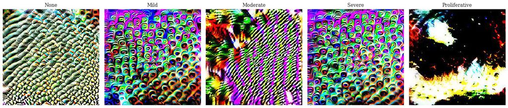 Class visualisations of the baseline network indicate a lack of convincing features. Mild and severe visualisations are very similar indicating the network has not learnt how to differentiate between them. Furthermore, the proliferative class completely lacks signal to generate a reasonable visualisation.