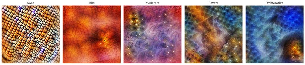 Improved network class visualisations indicate a progression of features associated with the class of diabetic retinopathy present.