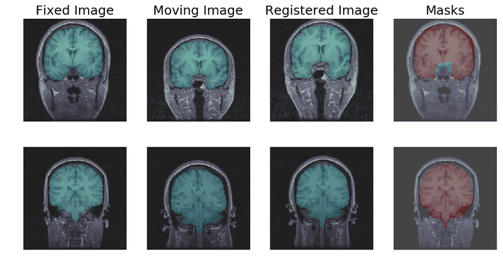 Deformable Image Registration