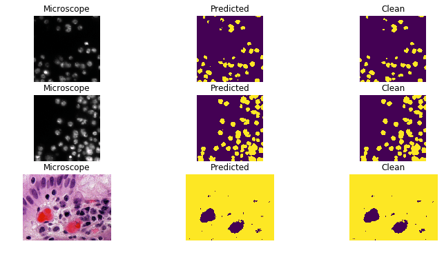 An example of image segmentation classifying cells under a microscope.